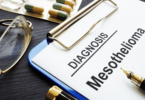 Mesothelial Cancer Insurance in Houston