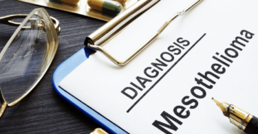 Mesothelial Cancer Insurance in Houston